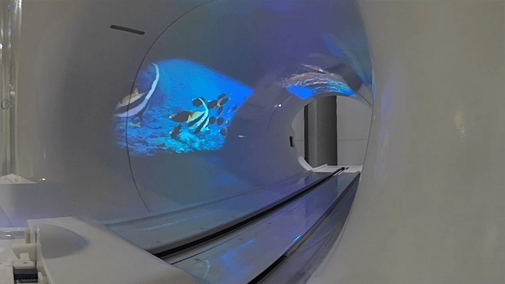 MRI側面に投影された魚の映像
